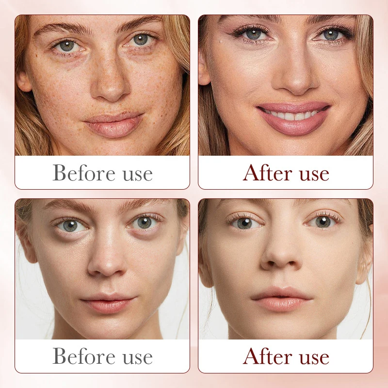 รอยัลดราก้อนเลือดเซรั่มพลาเซนต - Placenta Extract Serum บทวิจารณ์และราคา